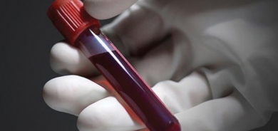 وزارة الصحة تنفي ما تردد عن وجود حاملي فيروس ‹الإيدز› في أربيل