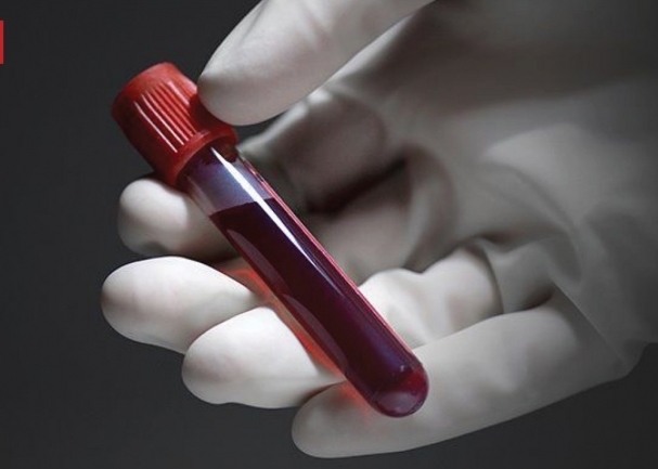 وزارة الصحة تنفي ما تردد عن وجود حاملي فيروس ‹الإيدز› في أربيل
