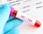 Pêketina bi vîrûsa HIVê 4 qatan zêde bûye 26 xulek berê