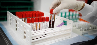 اختبار دم جديد يكشف العمر البيولوجي ويتنبأ بالإصابة بالأمراض !