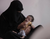 اليمن: تدخلات الانقلابيين في المساعدات فاقمت سوء التغذية