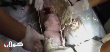 Rescuers Save Newborn From Sewage Pipe in China